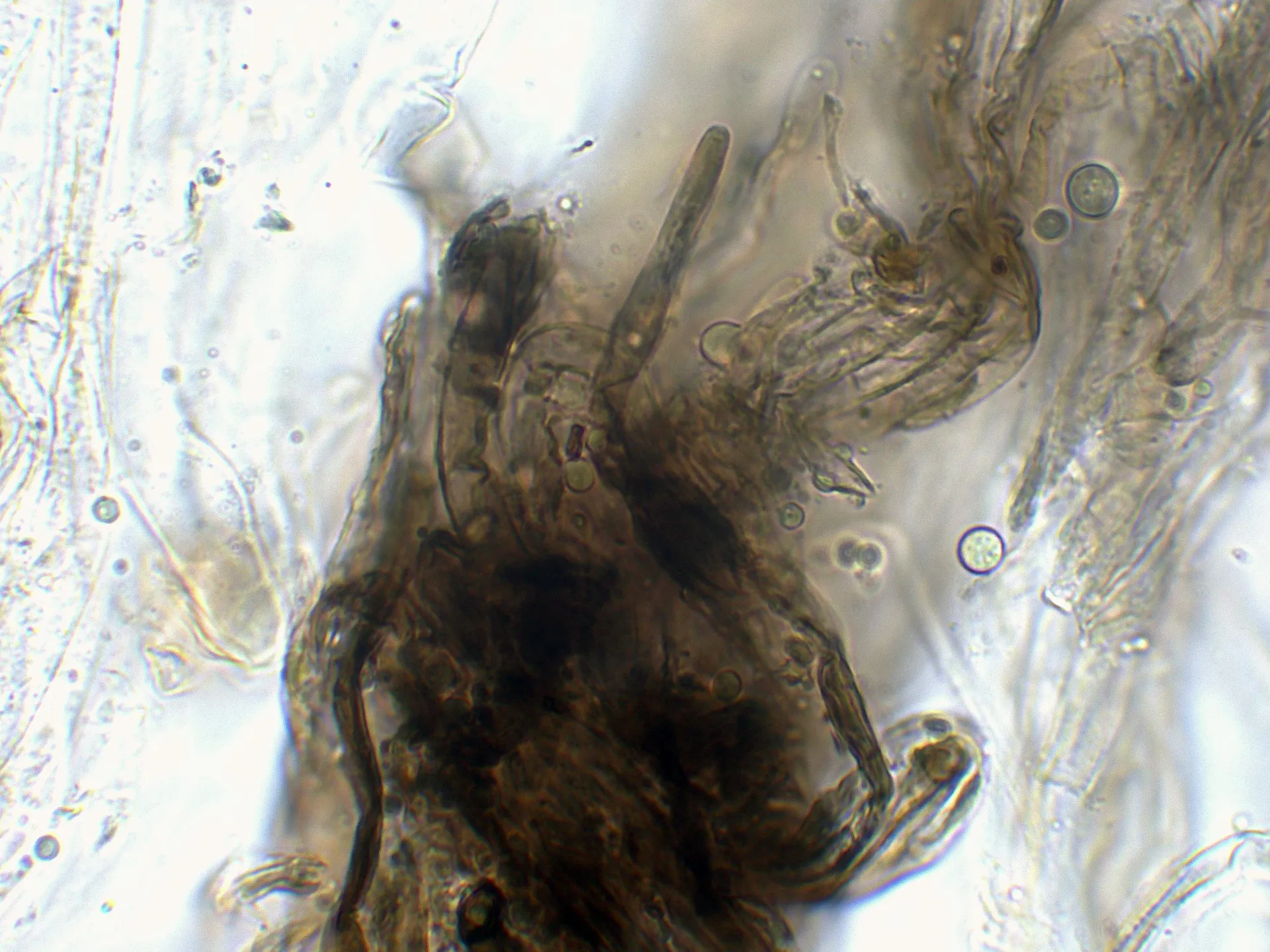 Microscopía de Tricholoma pardinum - 10 - Hifas escamas-003